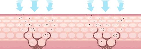 夏天肤色黑怎么办,黑黄暗沉肤色改善