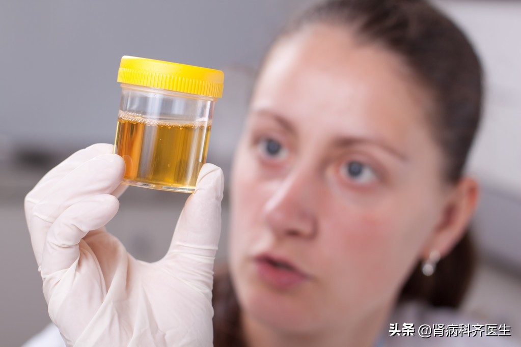 中医血尿与尿血的鉴别要点,尿潜血常见知识