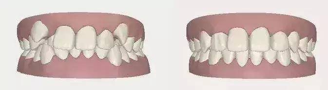 昊然弟弟全部图片,昊然弟弟视频