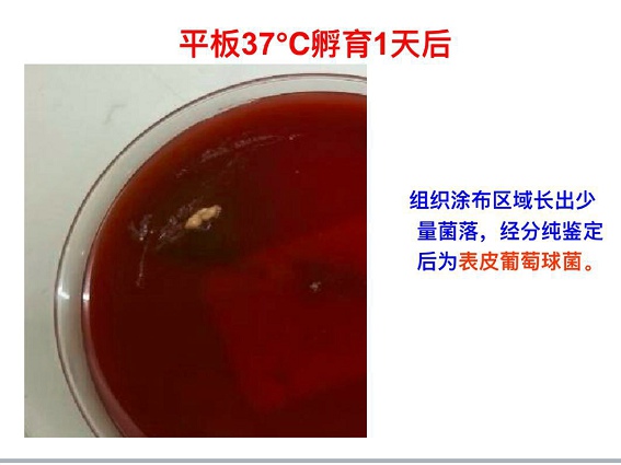 把胳膊砍掉疼不疼,医生能不能帮帮我