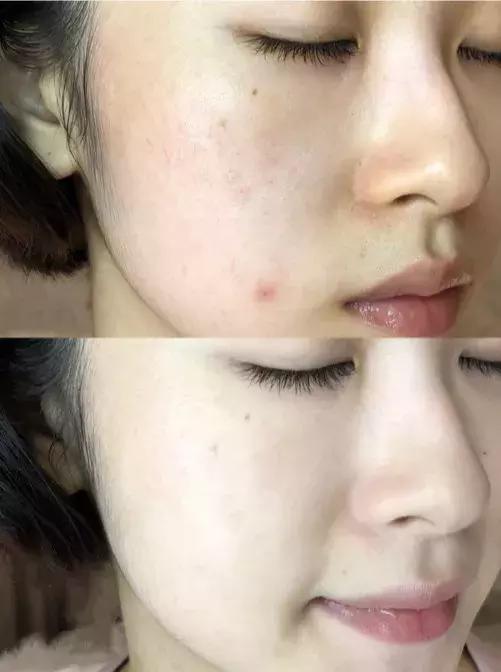 李湘国货精华液,李湘推荐的护肤品精华