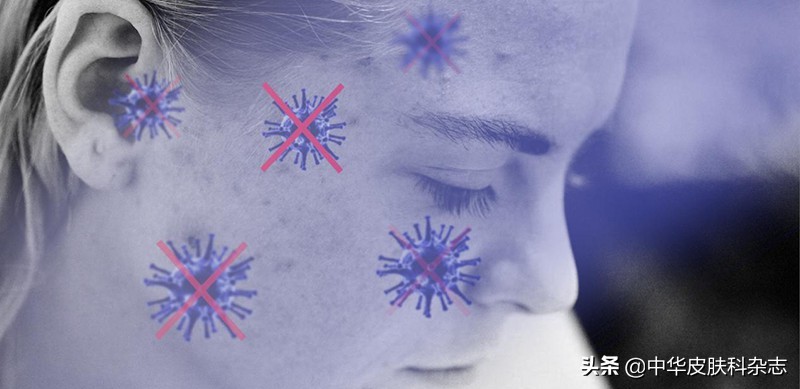 战痘全攻略详细解析,战痘全攻略详细