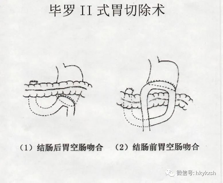 科普消化与健康,科普消化系统