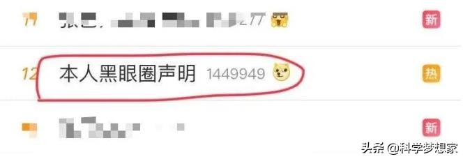 黑眼圈是咋回事,黑眼圈是怎么回事啊