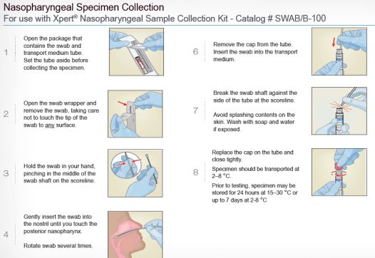 流感病毒筛查怎么做,流感病毒科普与防护小知识