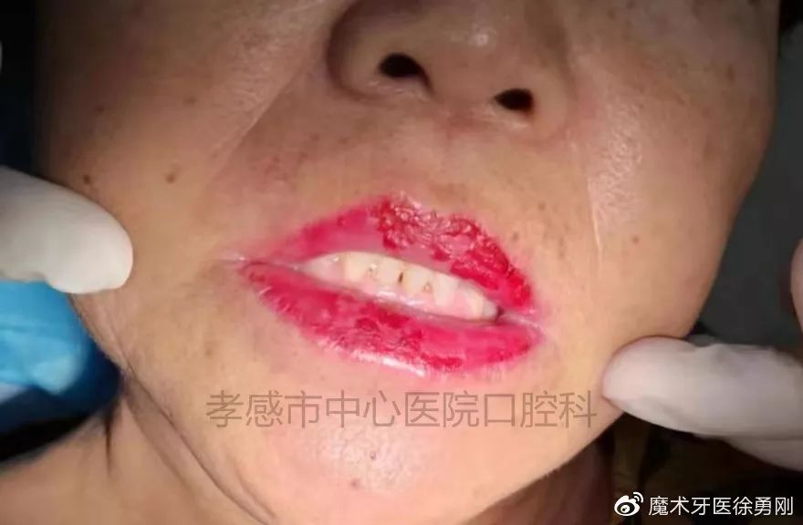 内行人为什么不建议漂唇,作为一名医生一直被人质疑