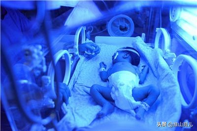 宝宝黄疸高可以在家自己照蓝光吗,宝宝黄疸照蓝光怎么操作