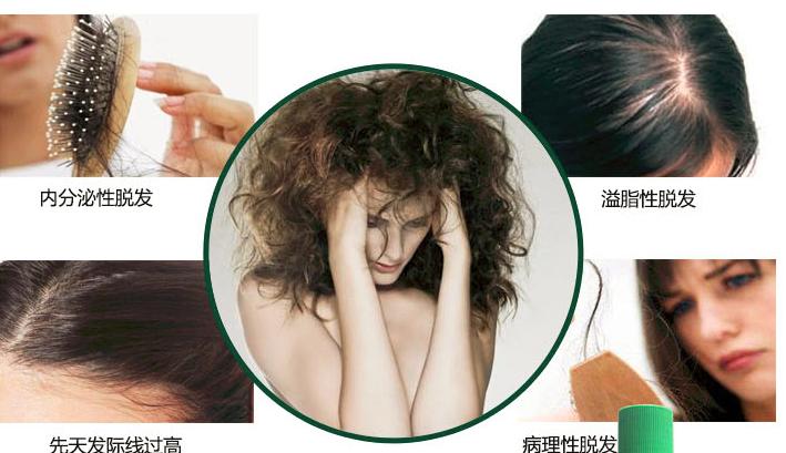 柳屋发根营养液护发精华液,日本柳屋发根营养液有效果吗