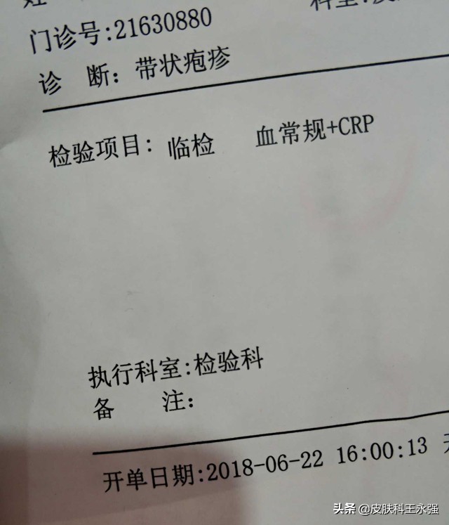 得了带状疱疹可能是什么病的征兆,警惕带状疱疹72小时内必须处理