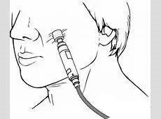 痘坑可以通过护肤手段平复吗,痘坑如何正规治疗