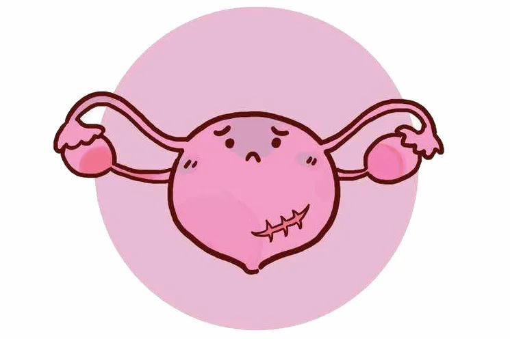 90分钟惊心动魄历险记｜疤痕子宫仅0.15cm厚，二胎孕妈成功顺产7.4斤宝宝