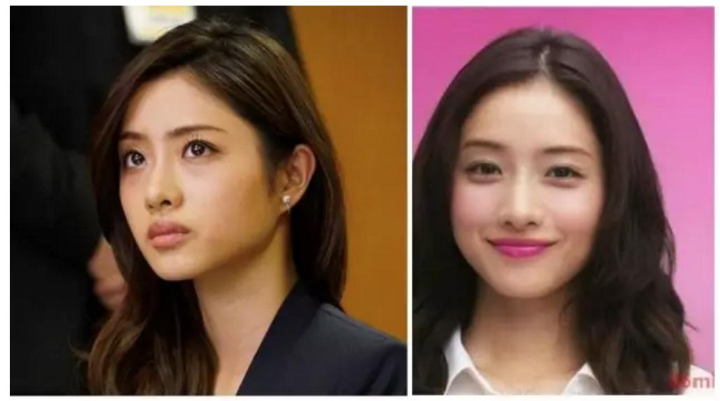 少年法令纹和痘坑显老,显老元凶法令纹