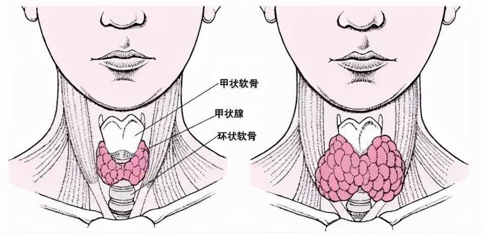 疏调气机法,疏调气机汤中药方