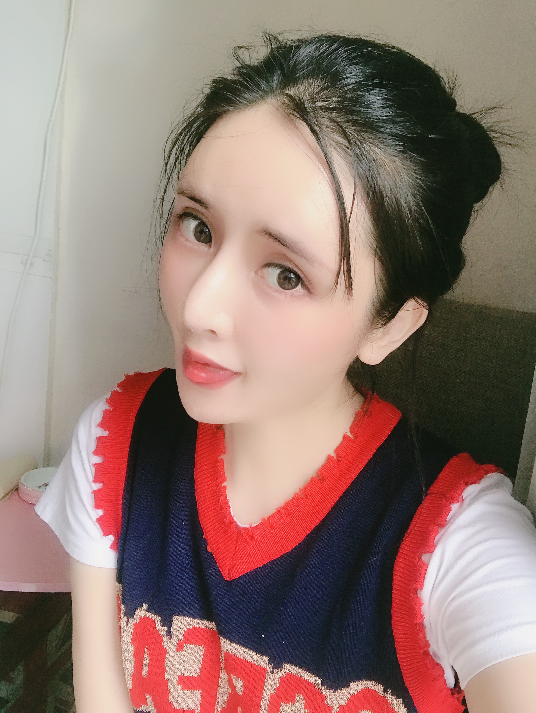 福州韩尔隆鼻案例,福州韩尔医疗美容曝光