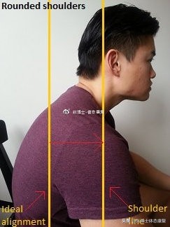 肩胛骨突出矫正的方法,体态矫正脊柱前凸