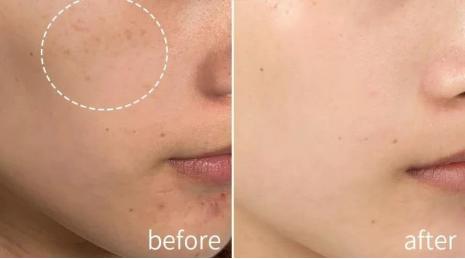 吉米祛斑怎么使用视频,吉米的祛斑产品真的可以祛斑吗