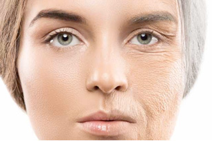 做眼部护理后怎么保养,做眼部护理能淡化黑眼圈吗