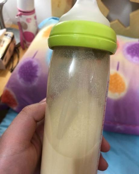 剖腹产第八天刀口表面有裂开,产妇生产剖腹产家人笑着说不同意