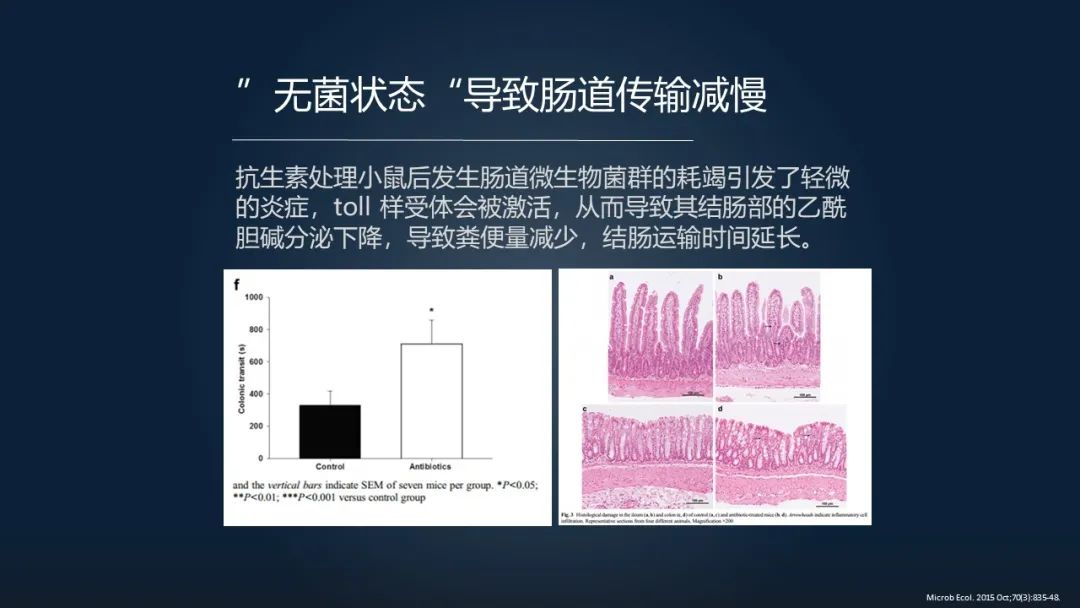 一招调理肠道改善便秘,肠道水疗治便秘有效吗