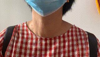 甲状腺结节会因为生气而变大吗,甲状腺结节会因为生气变大吗