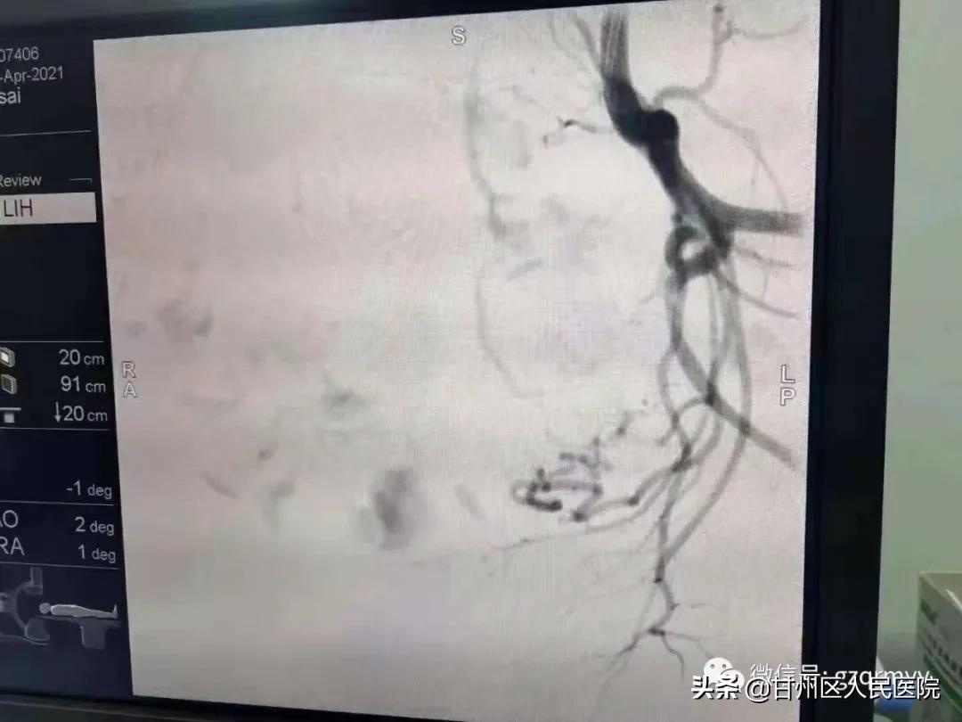 妇产科新技术有哪些应用,妇科门诊新技术