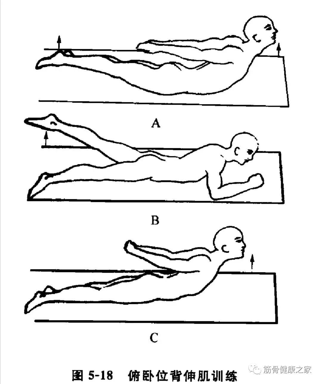 腰椎间盘突出4-5压迫神经康复训练,腰椎间盘突出症的最佳锻炼方法