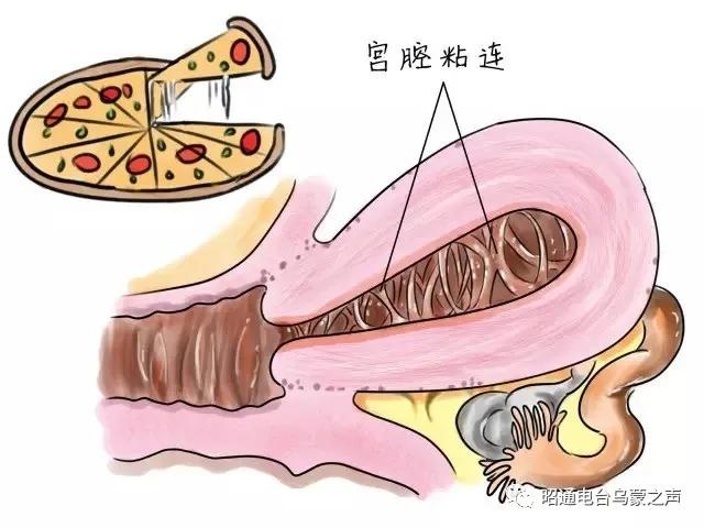 助您好“孕”《祝您健康》昭通仁安医院彭艺医生教你备孕知识