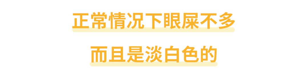 早上起床眼屎多是肝火大吗,早晨起床有眼屎是怎么回事