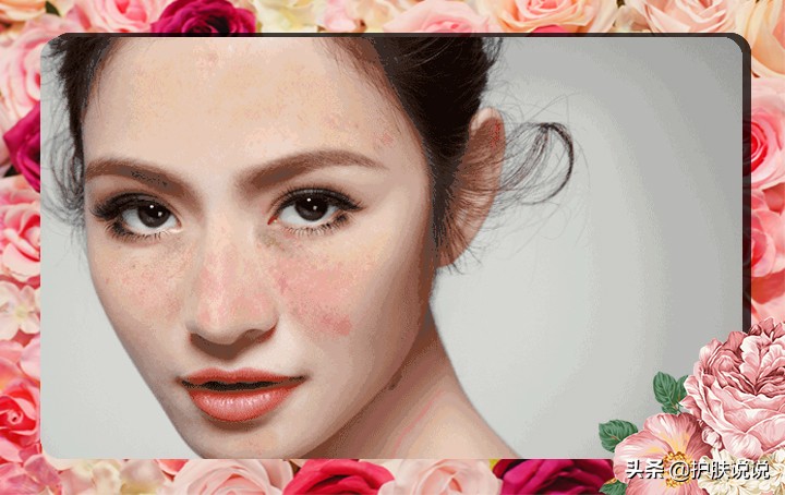 光子嫩肤最全介绍,光感美白和嫩肤美白有什么区别