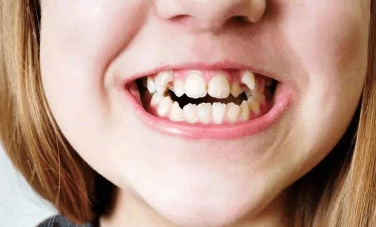 可爱的牙,可爱的老虎牙