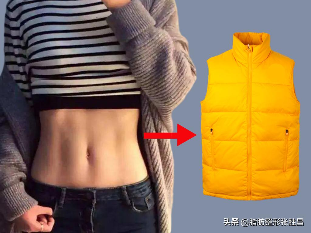 想要马甲线可以练出来吗,腰腹吸脂马甲线恢复过程