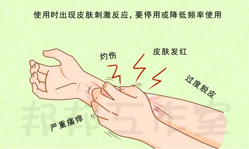 斑块状银屑病治疗方法,中度斑块银屑病怎么治疗最好