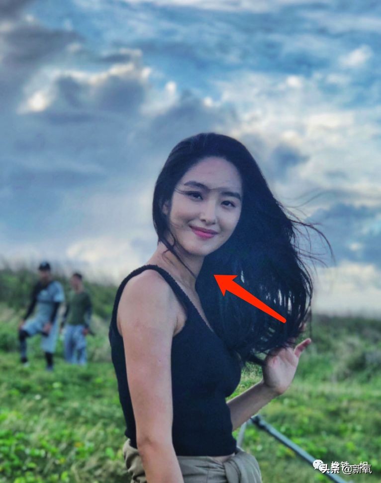 抢了刘亦菲干爹还发博踩天仙，但她这个部位肿得惊人