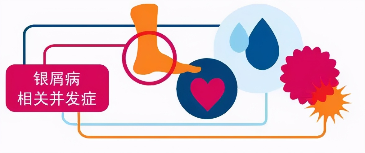 银屑病有什么危害不治会怎样,银屑病长期抹药膏有什么危害