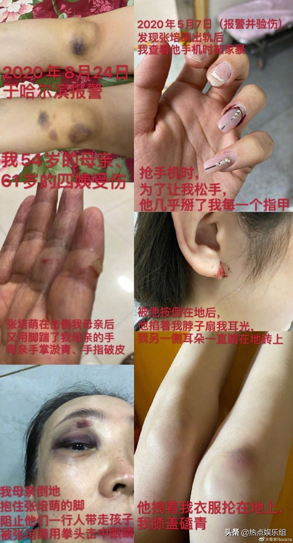 张培萌被反转,张培萌被曝家暴官方解释