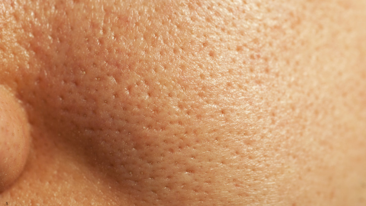 城野医生改善毛孔,城野医生牌子还能买吗