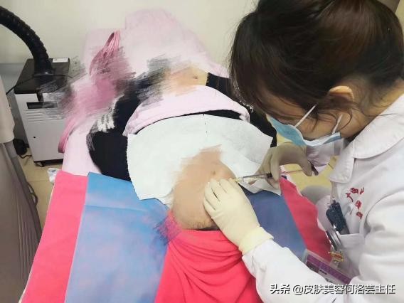 无针水光涂抹式,注射式