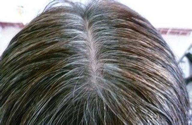 生发养发吃什么食物防止脱发,生发护发的食补方法有哪些