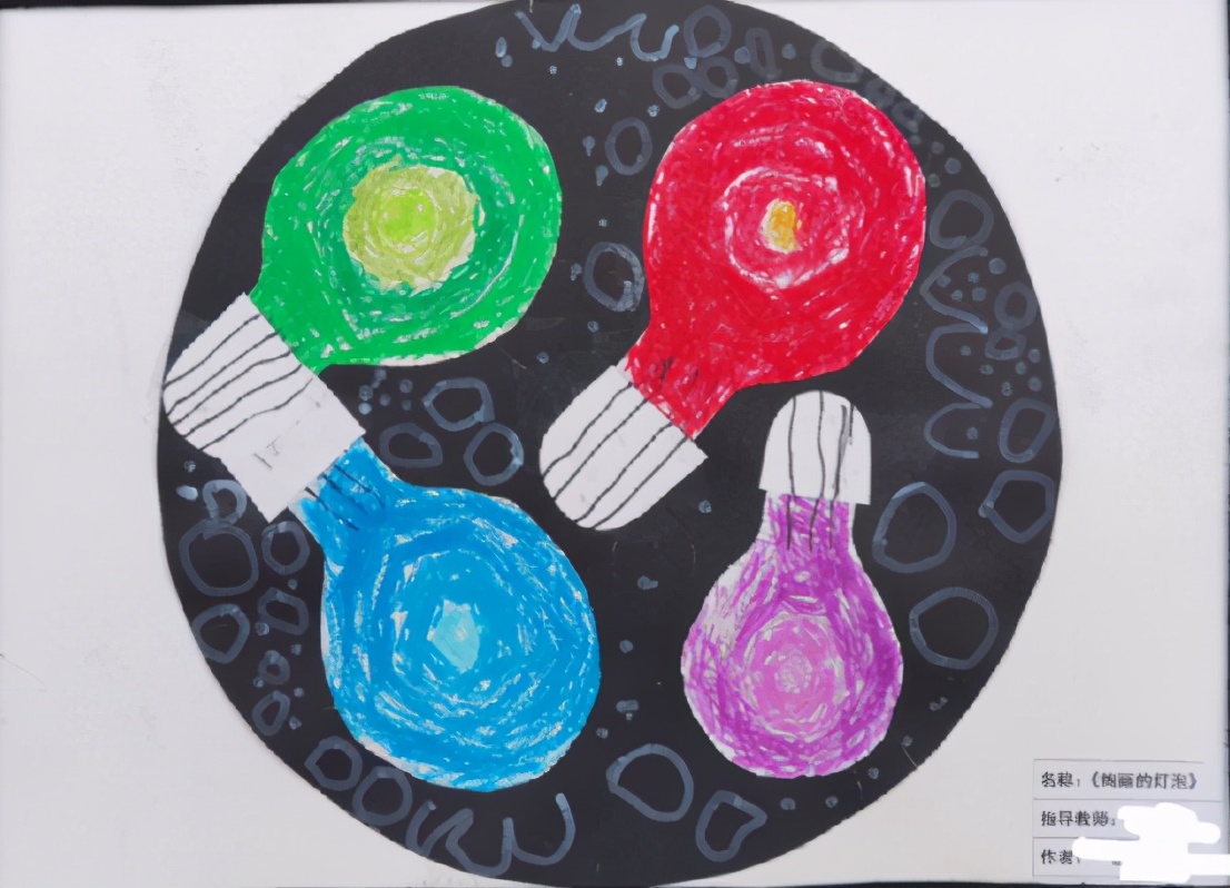 洗澡时发现左大腿包块四个月的女儿成为科室最小的患癌儿童