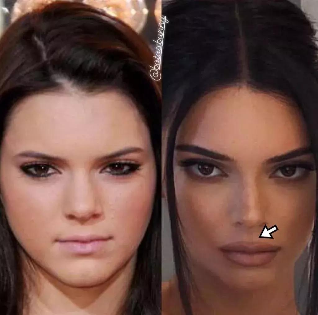 厚嘴唇有多美,厚嘴唇也很好看的女生