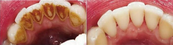 濂冲+鍙h厰棣欐按鎸佷箙鐣欓,濂介椈鍙h厰鍠烽浘棣欐按
