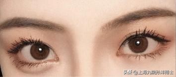 孙沣眼修复有成功案例么,眼修复能找原来医生修复吗