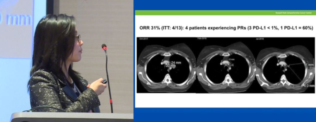 新型肺癌疫苗有望攻克,对抗癌症的疫苗