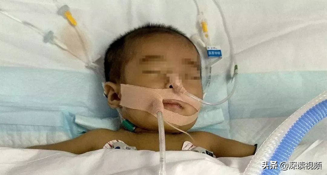 早期肝硬化有什么蛛丝马迹吗,如何判定早期肝硬化和晚期肝硬化