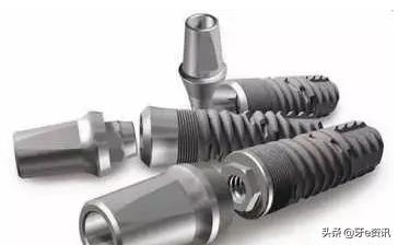 烤瓷牙价格表图种植牙,种植牙与烤瓷牙利与弊