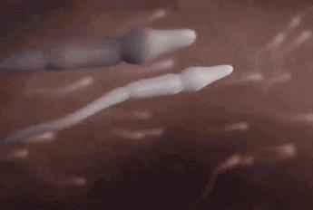 医生打胎的真实故事,人流手术的真实案例