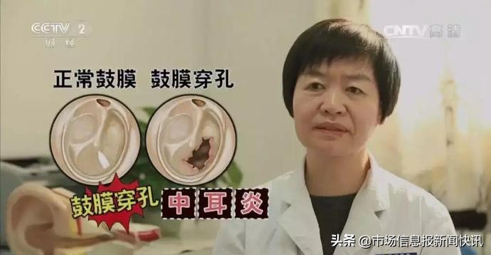 成都刀锋洗眼洗出虫子,刀锋洗眼可以做吗