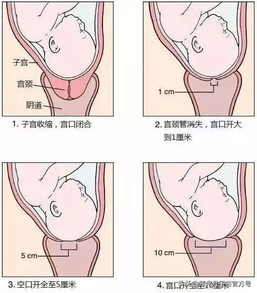 顺产开十指是十根手指宽吗,顺产开十指相当于多少根肋骨