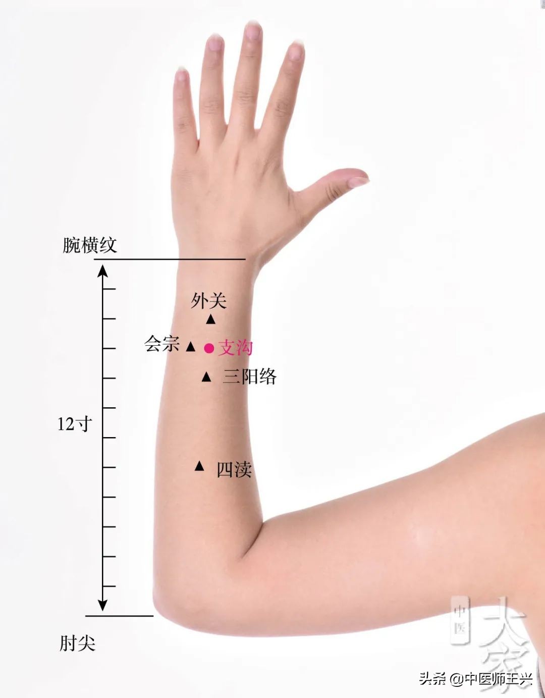 带状疱疹辨证治验——针灸+知柏地黄汤