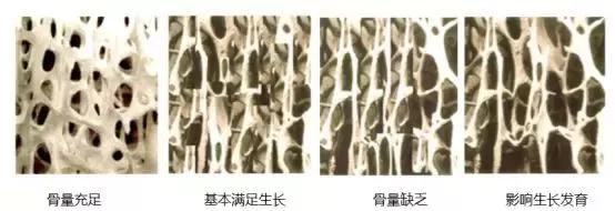 娃儿经常喊脚痛,娃儿老是喊脚软怎么回事